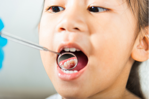 kid-with-cavities kid-with-cavities