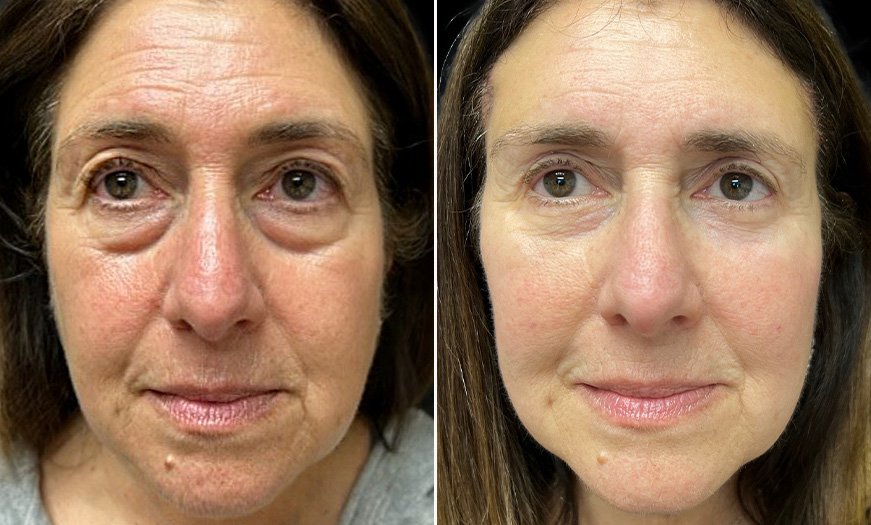Client result example