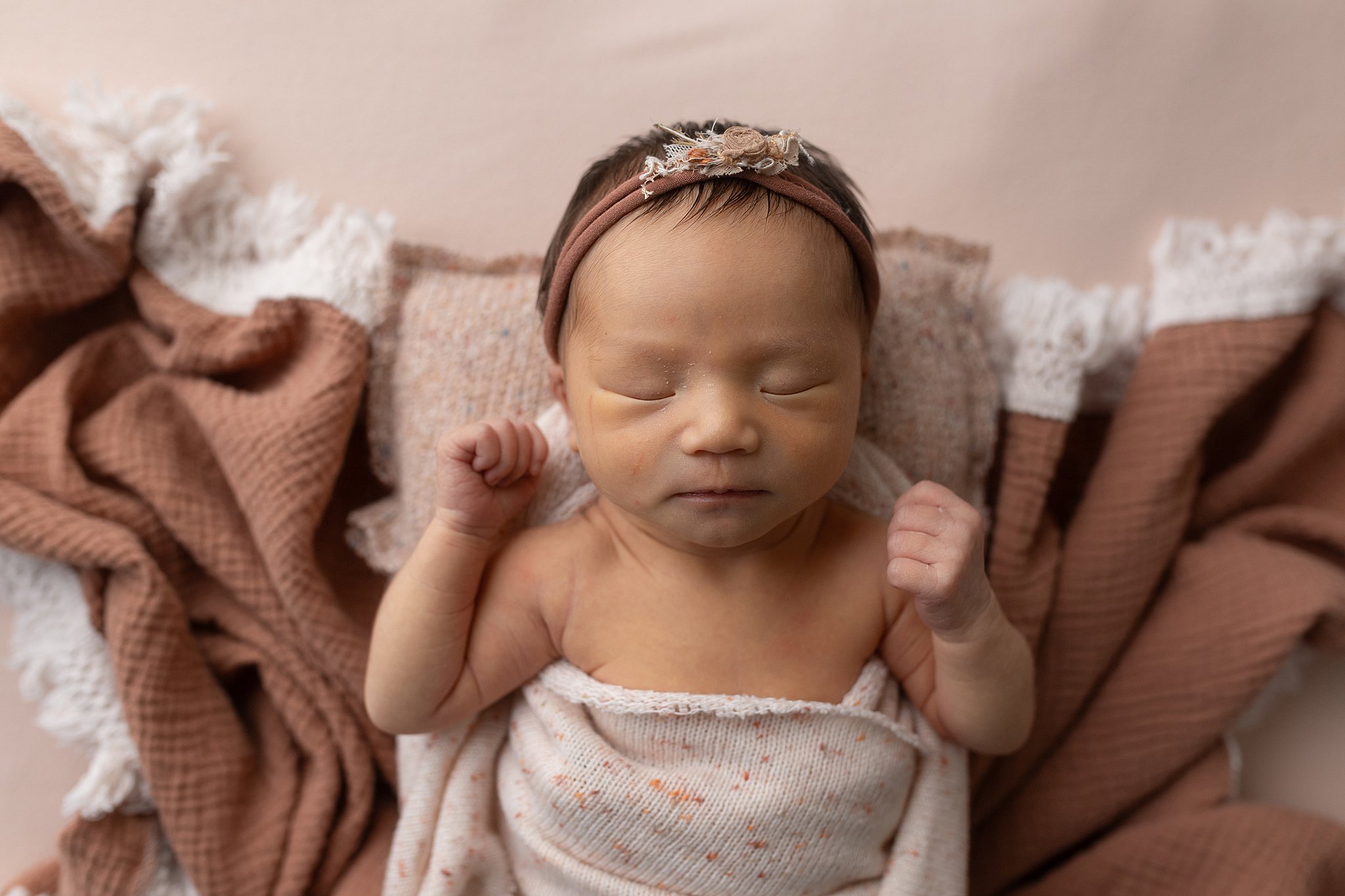 Newborn photo before jaundice color correction showing yellow skin cast