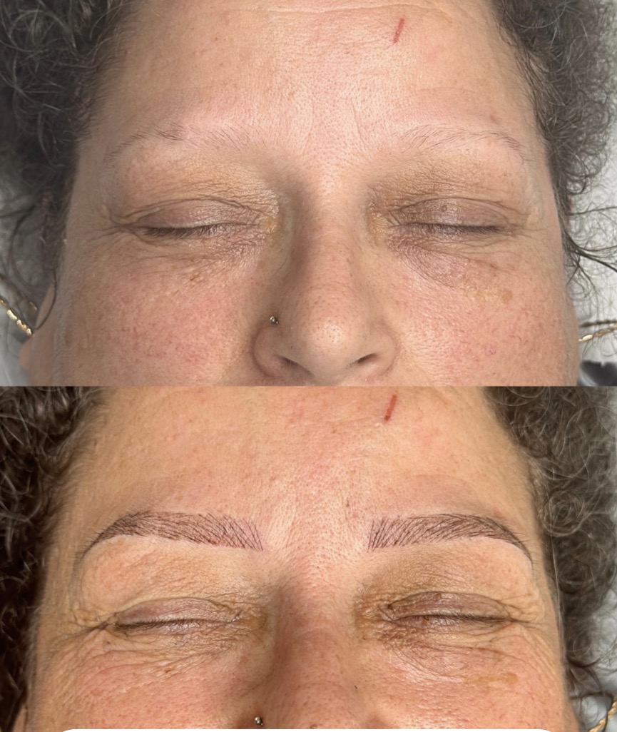 Eyebrows before treatment above and after treatment below