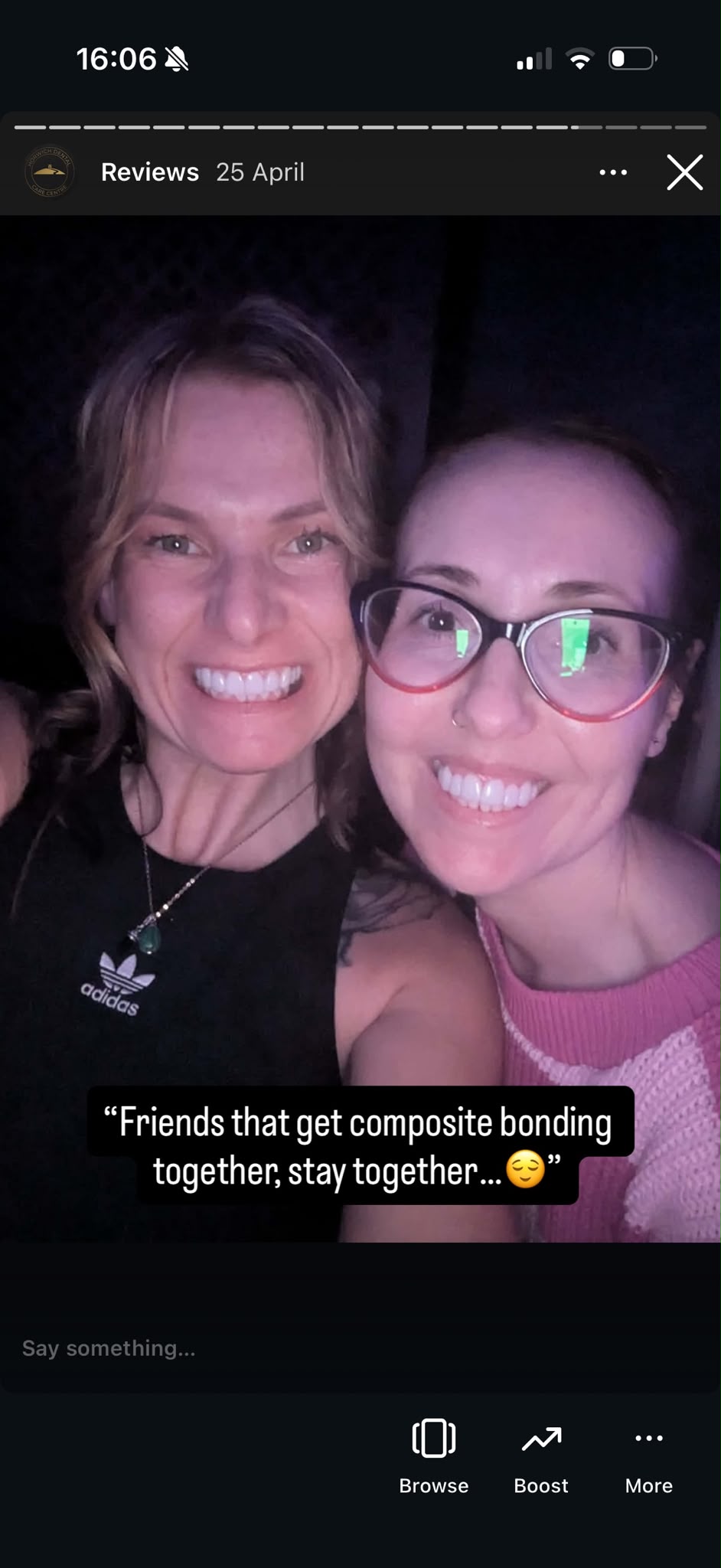 Composite bonding smile gallery image