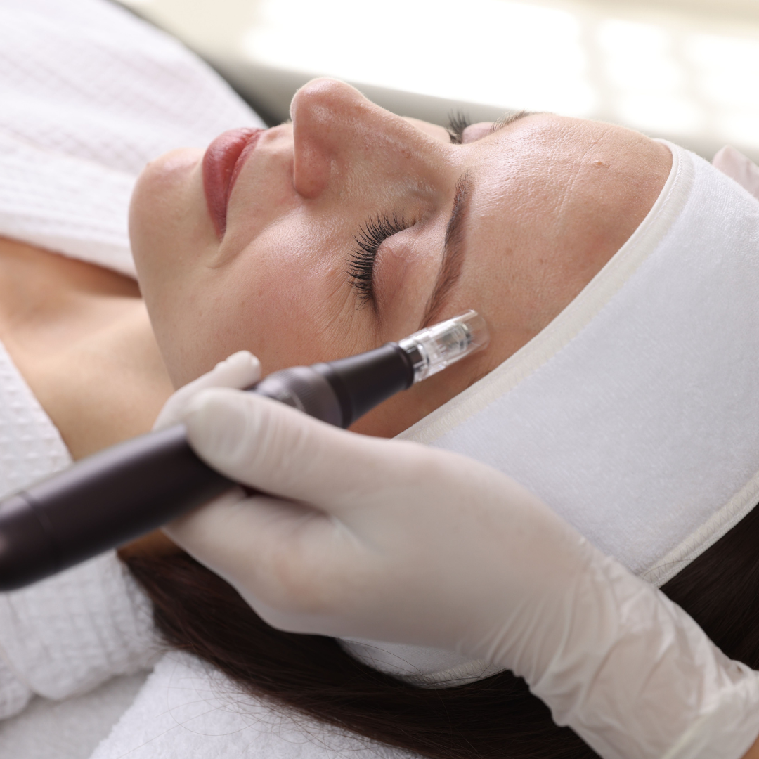Traitement de microneedling