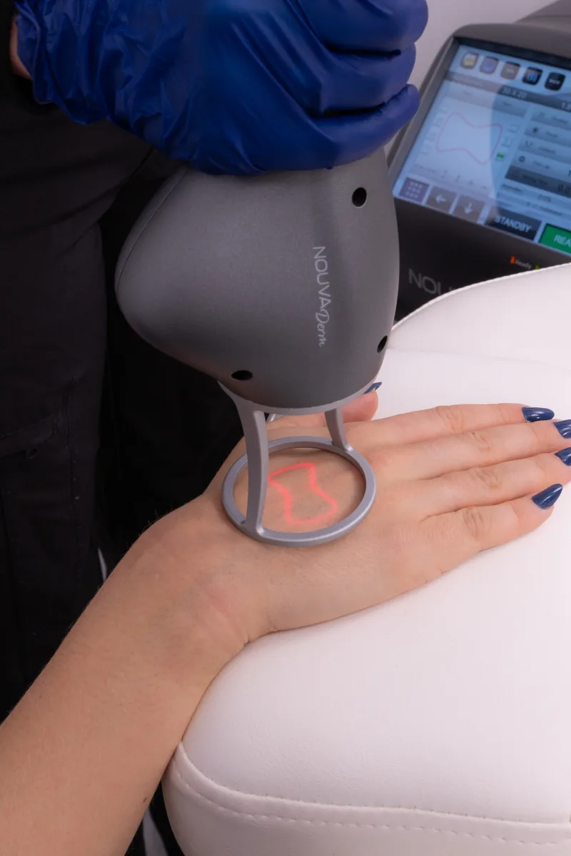 Advanced laser treatments at 1st Care Med Spa in Mesa, Arizona