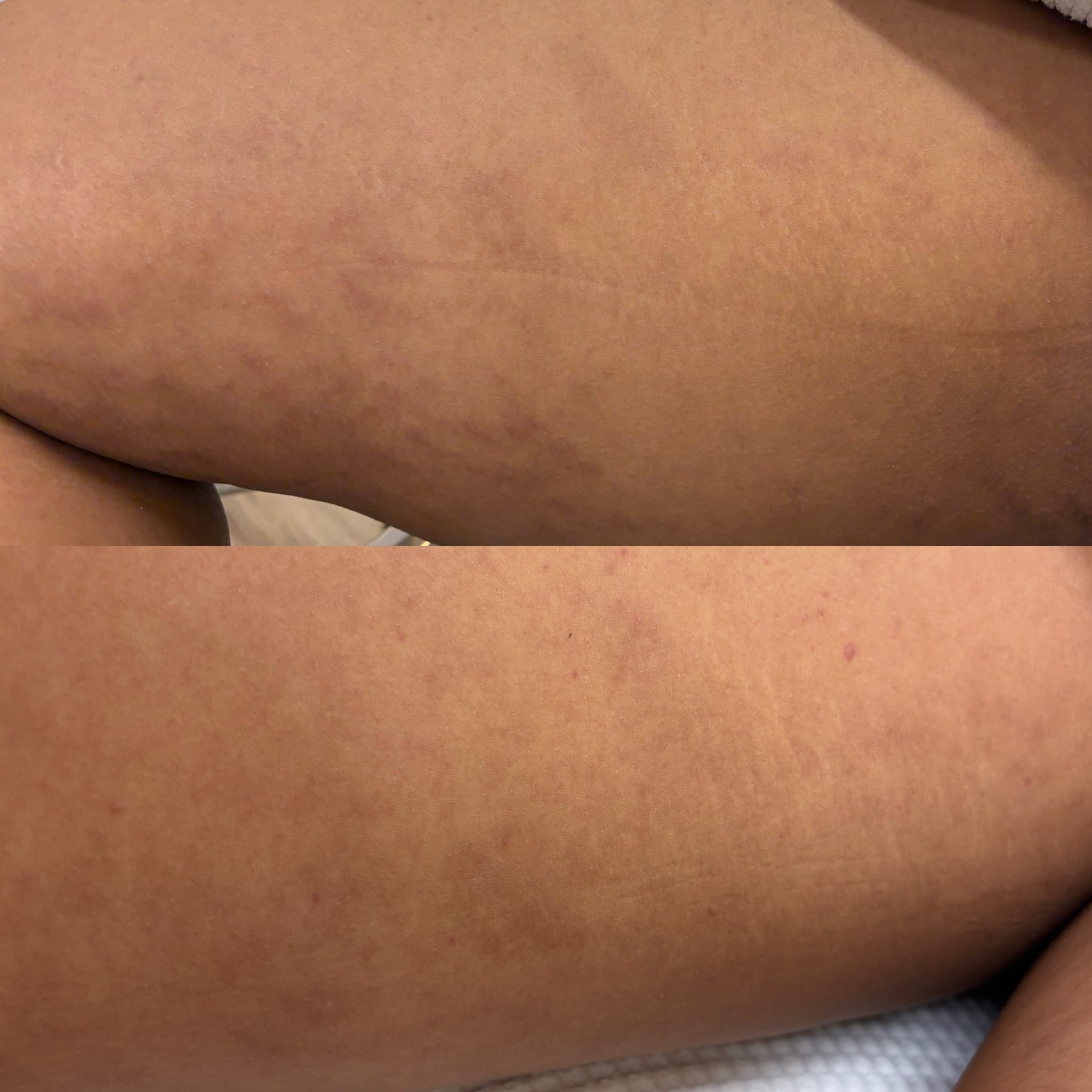 Client skin result before and after treatment at Pearl & Sage
