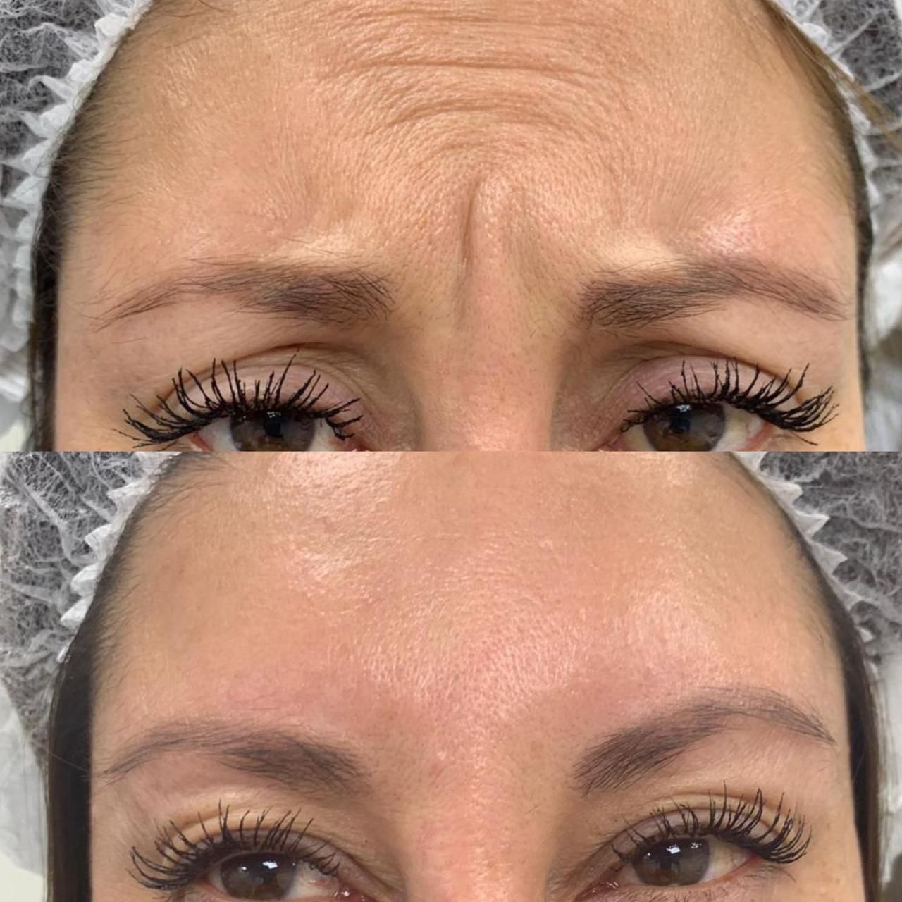 Antes y después de un paciente de Clínica Visage, caso 12