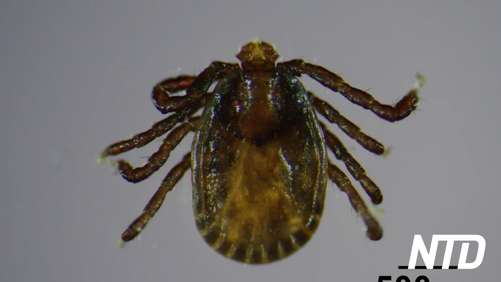 People with Penicillin Allergy More Likely to Develop Serious Infections