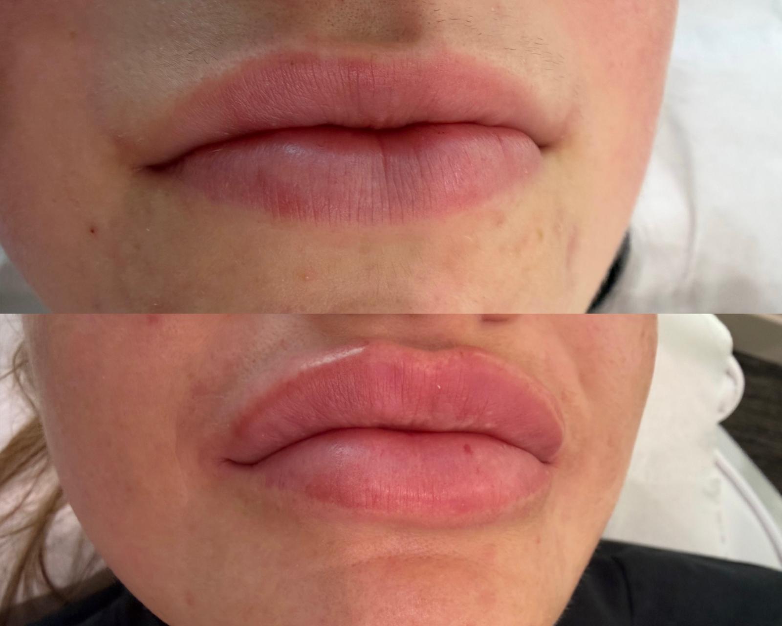 Client result
