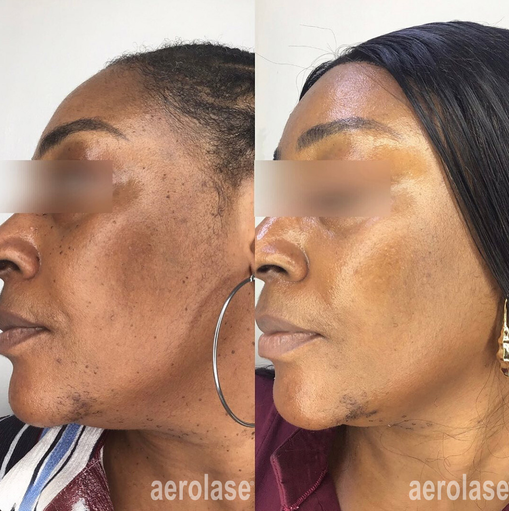Client result