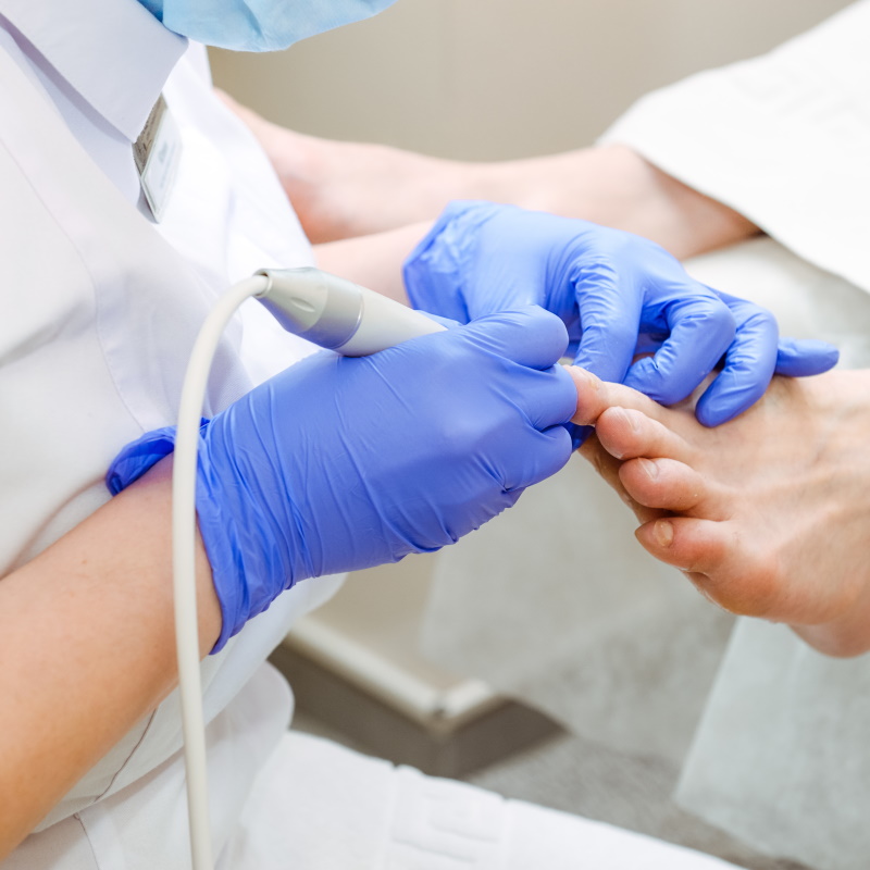 Routine Podiatry