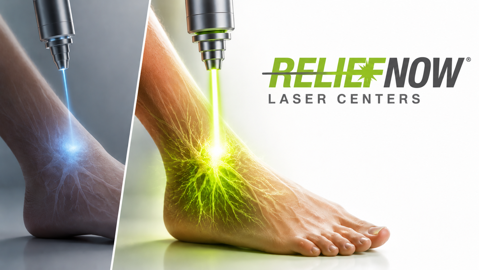 High-Power Laser Therapy for Peripheral Neuropathy — The Laser Masters