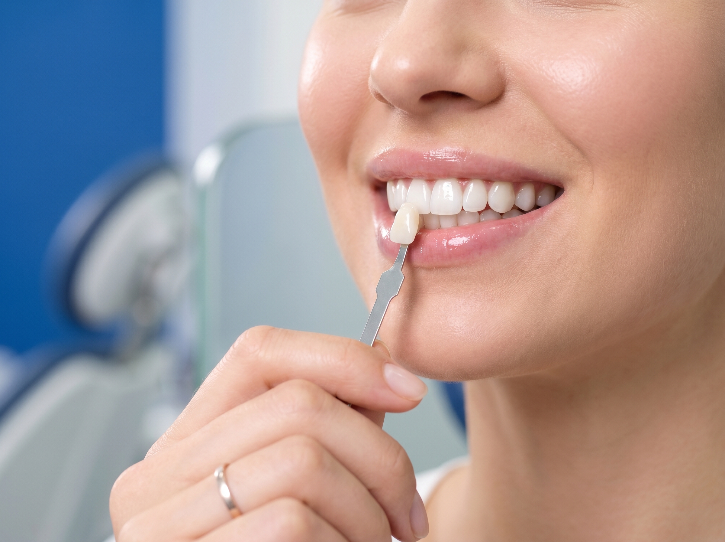 Diseño de sonrisa y estética dental en Simetría Dental Studio, Machalí