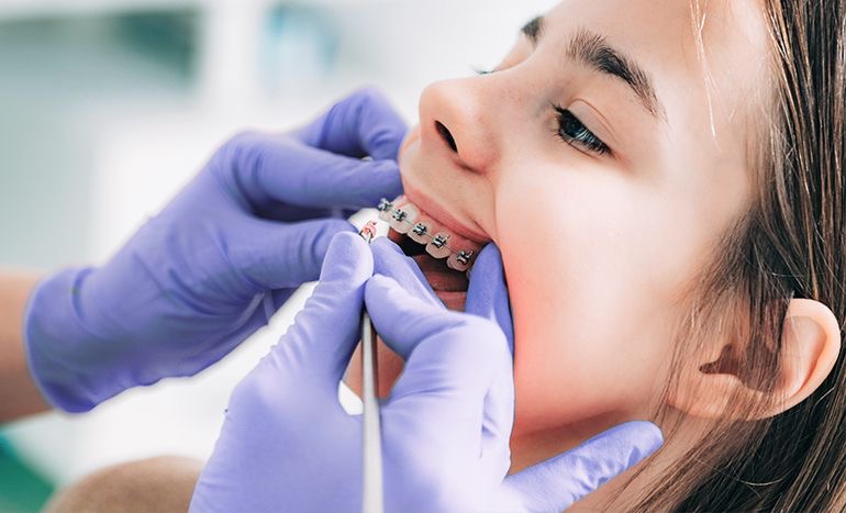 Ortodoncia y Ortopedia Dentomaxilofacial Machalí — Simetría Dental Studio