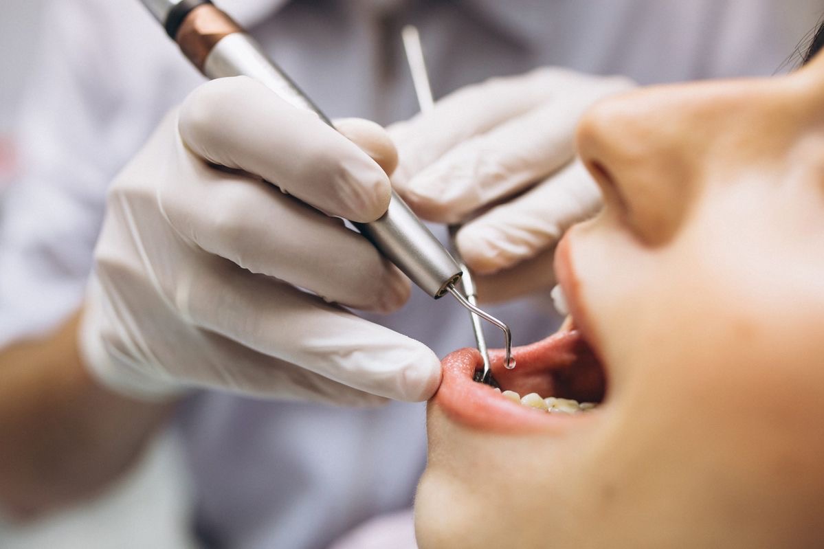 Endodoncia Machalí — Simetría Dental Studio