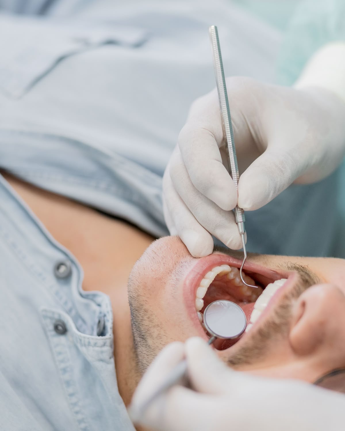 Limpieza dental y flúor Machalí