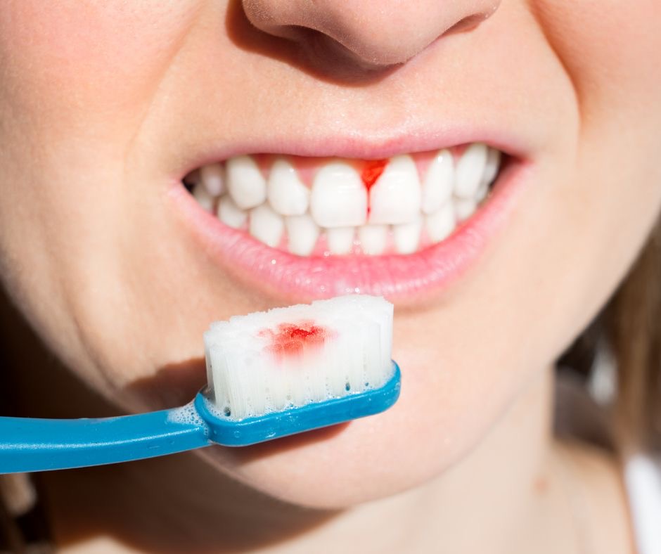 Periodoncia