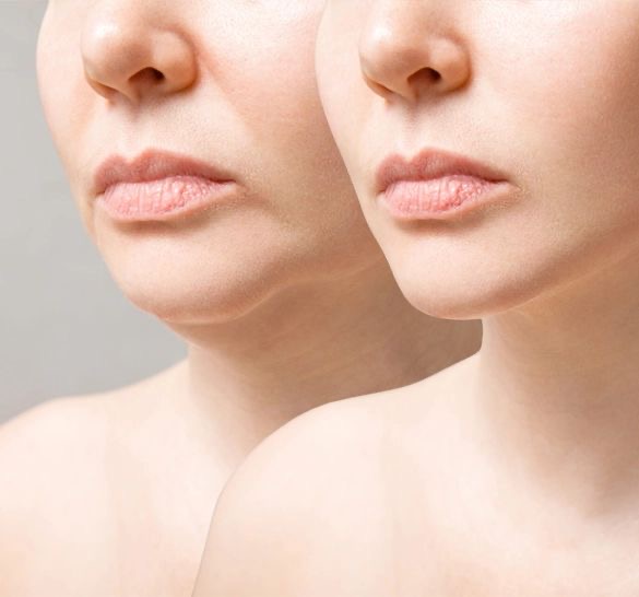 Lipopapada