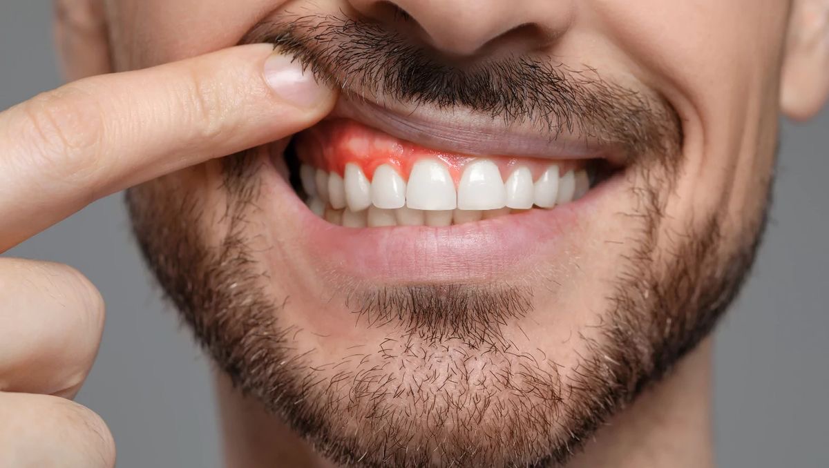 Periodoncia Dental Vitacura