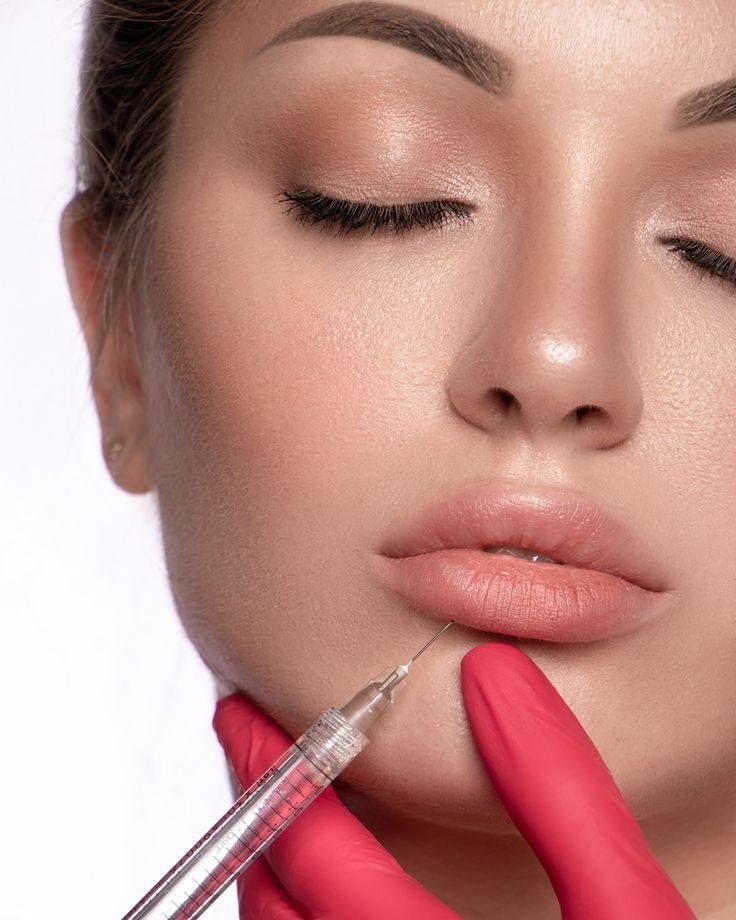 Relleno de labios resultado