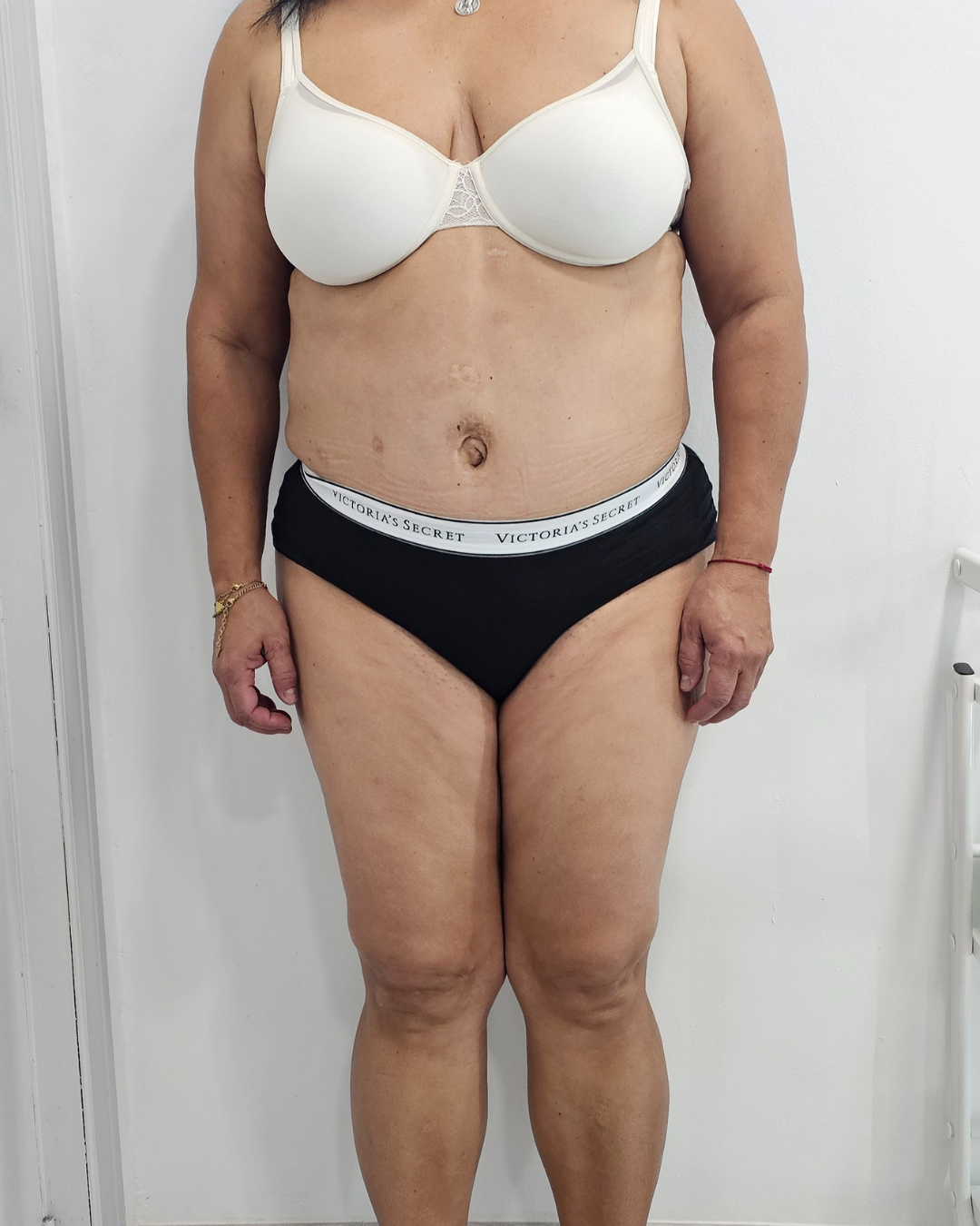 Antes · T-SHAPE 360