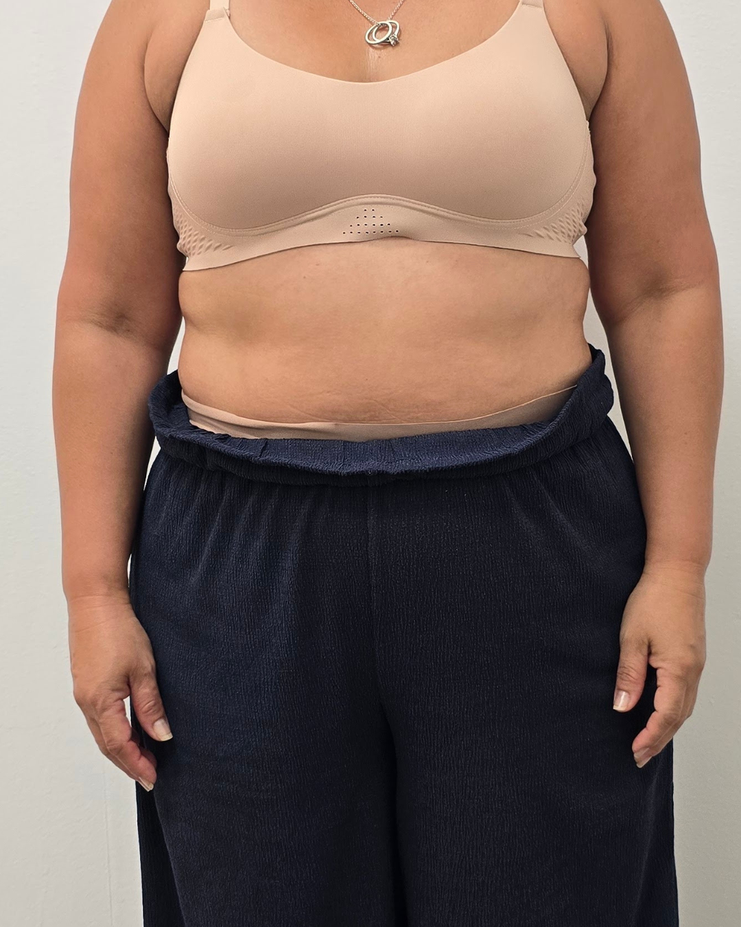 Antes · T-SHAPE 360