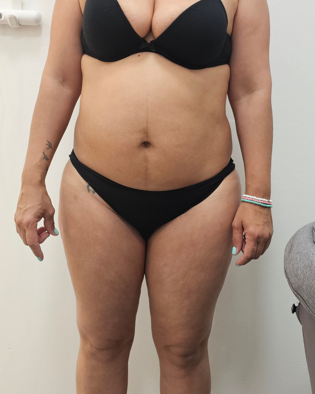 Antes · PRO SHAPE 360