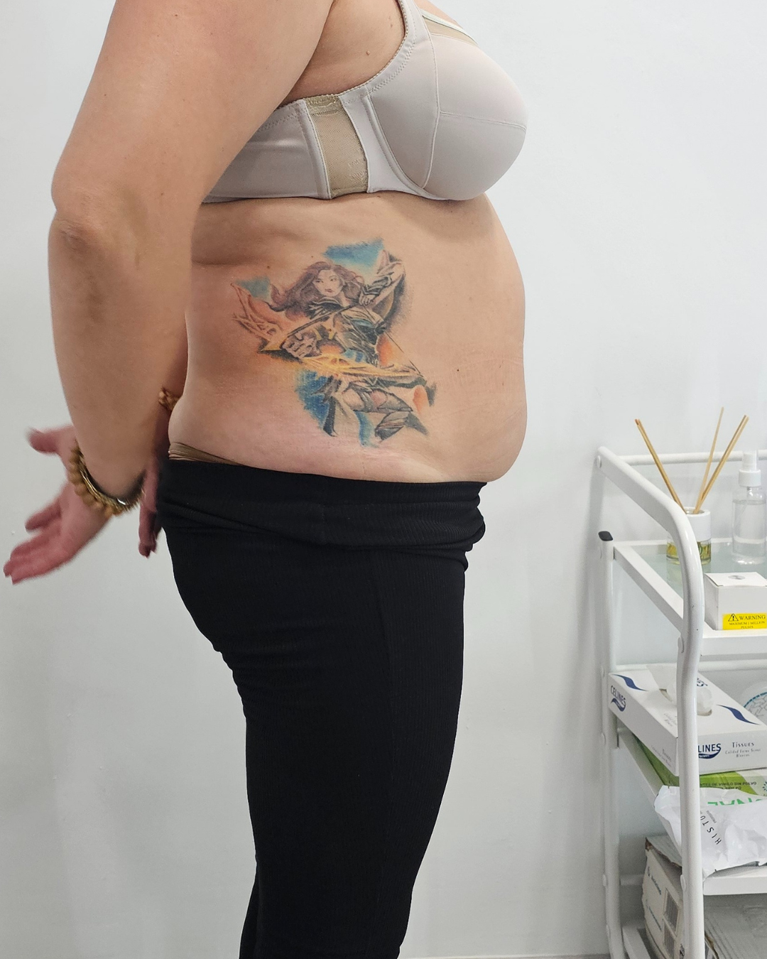 Antes · PRO SHAPE 360