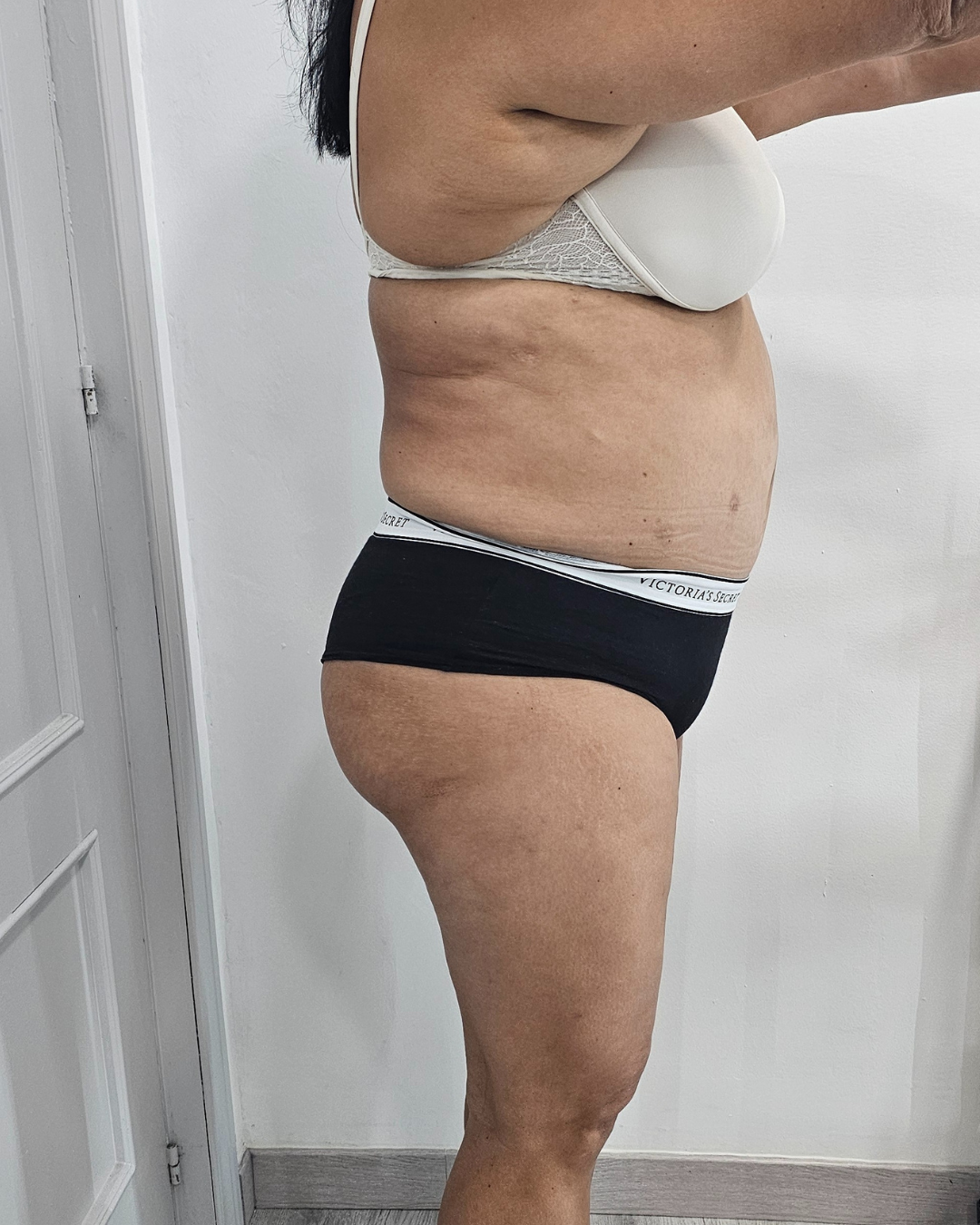 Antes · PRO SHAPE 360