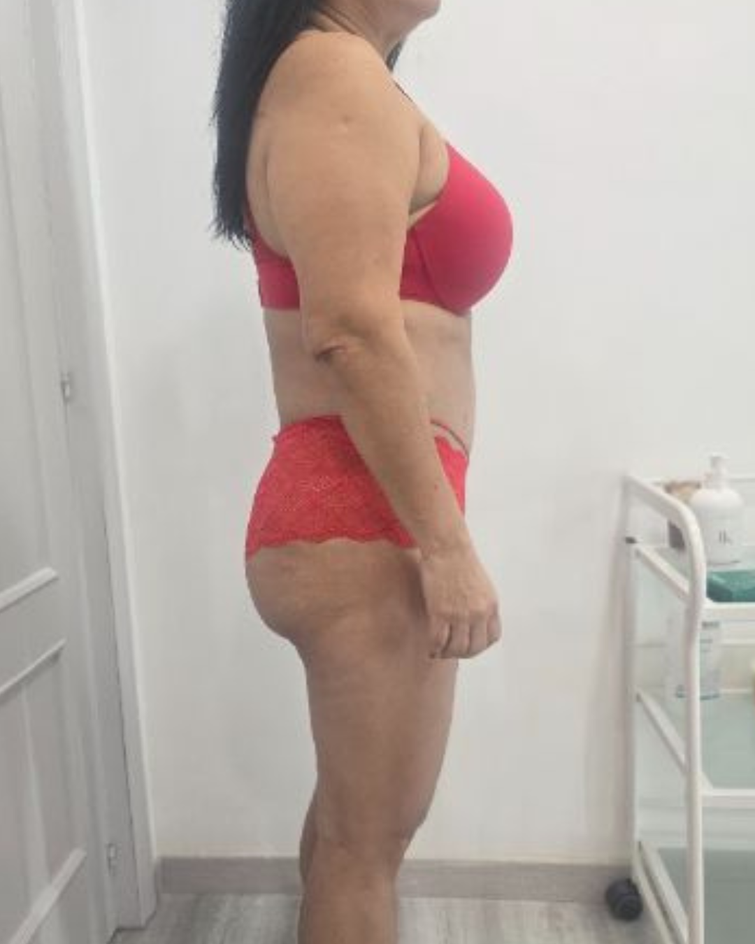 Después · PRO SHAPE 360