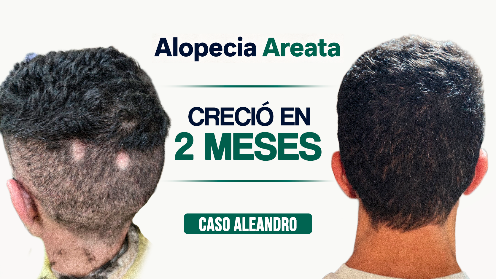 Caso Alejandro · antes y después