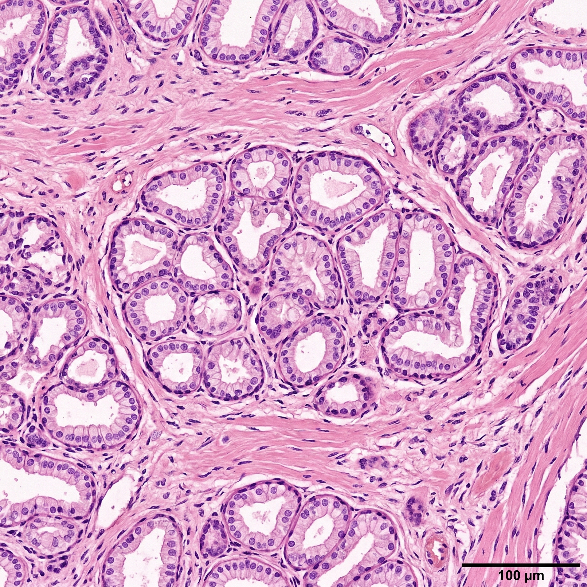 Microscopy of healthy nourished prostate tissue showing dense cell structure