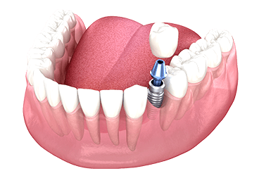 Effective Orthodontic Solutions