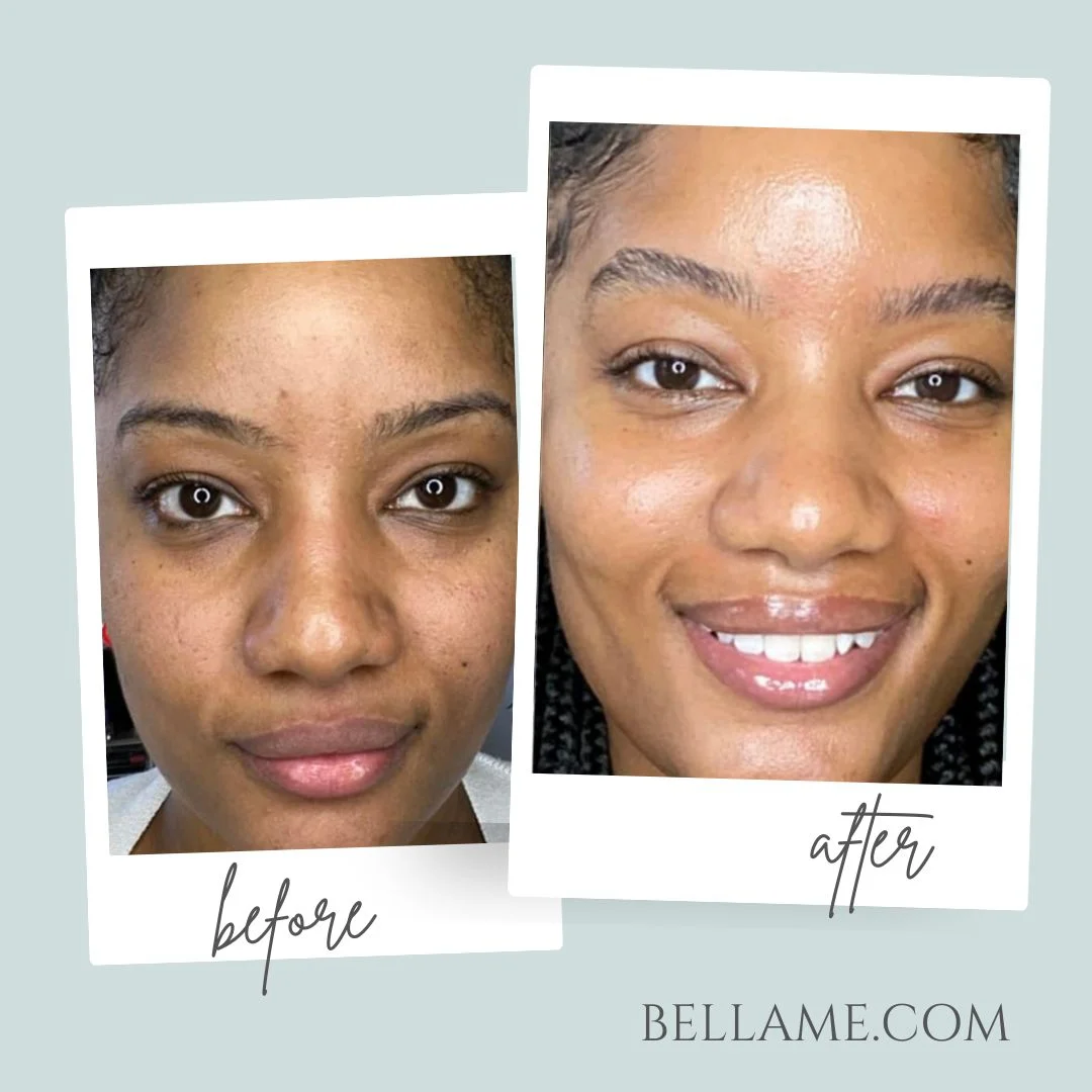 Before and After Results