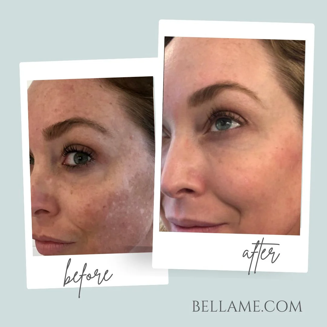 Before and After Results