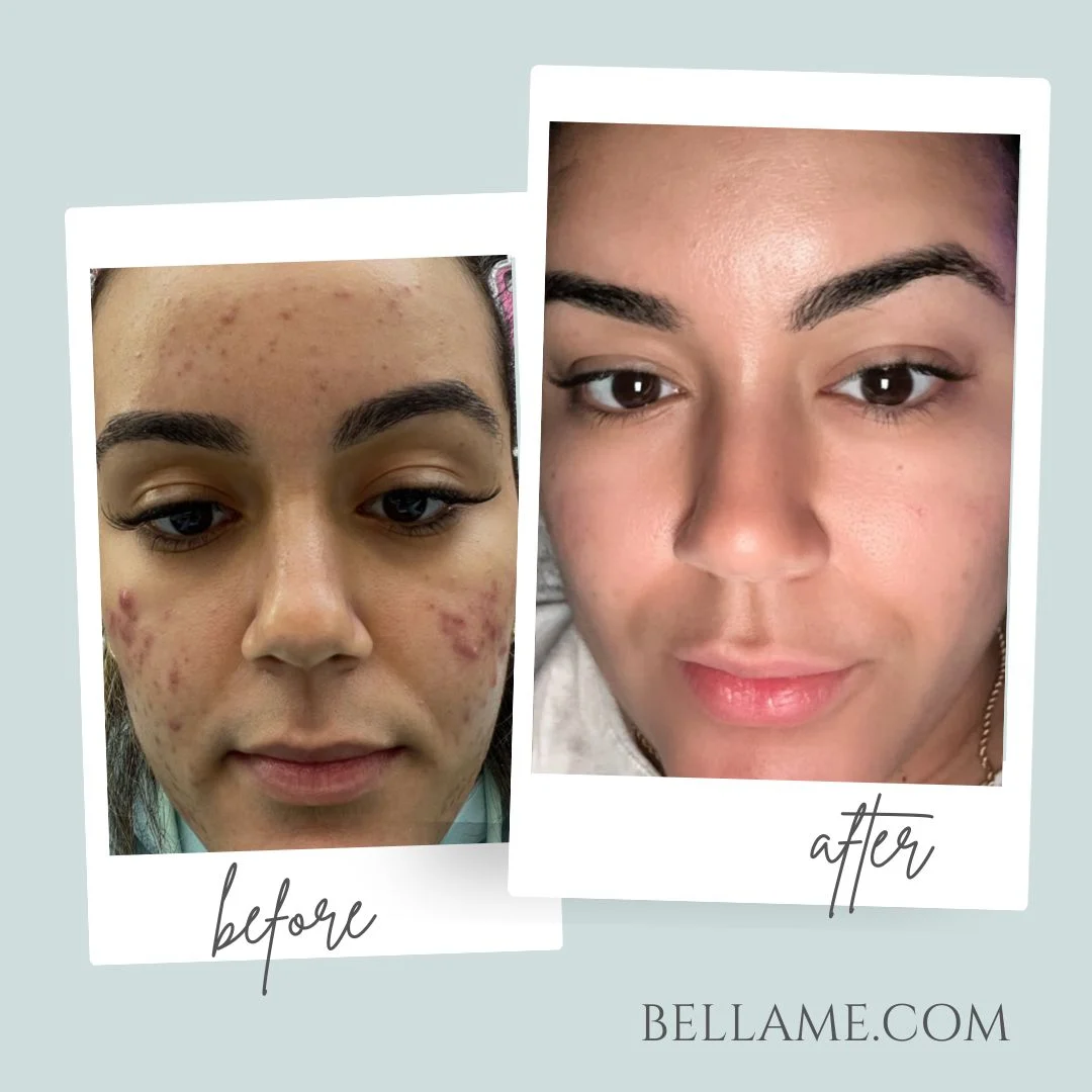 Before and After Results