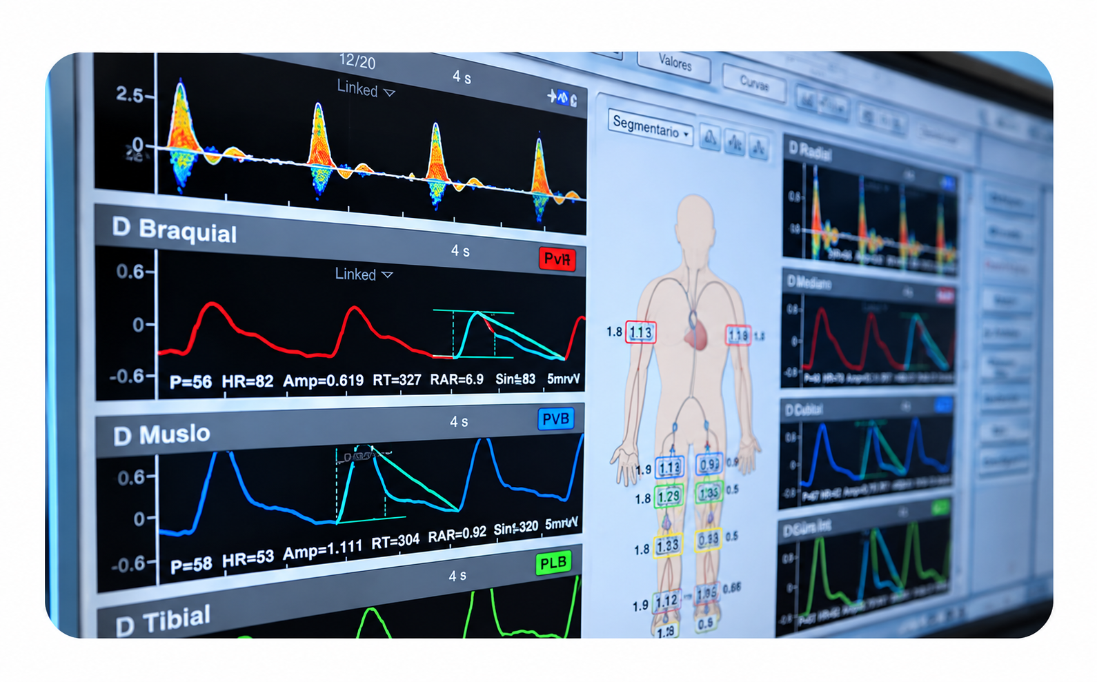 MÉTODOS DE DIAGNÓSTICO VASCULAR NO INVASIVO