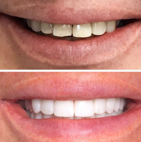 Dr. Svetlana performing full-arch implant consultation