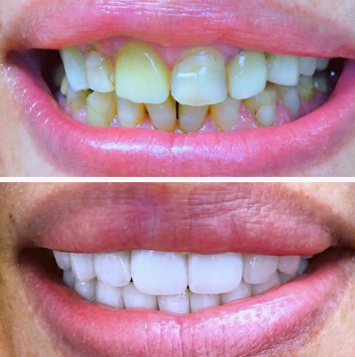 Dr. Svetlana performing full-arch implant consultation