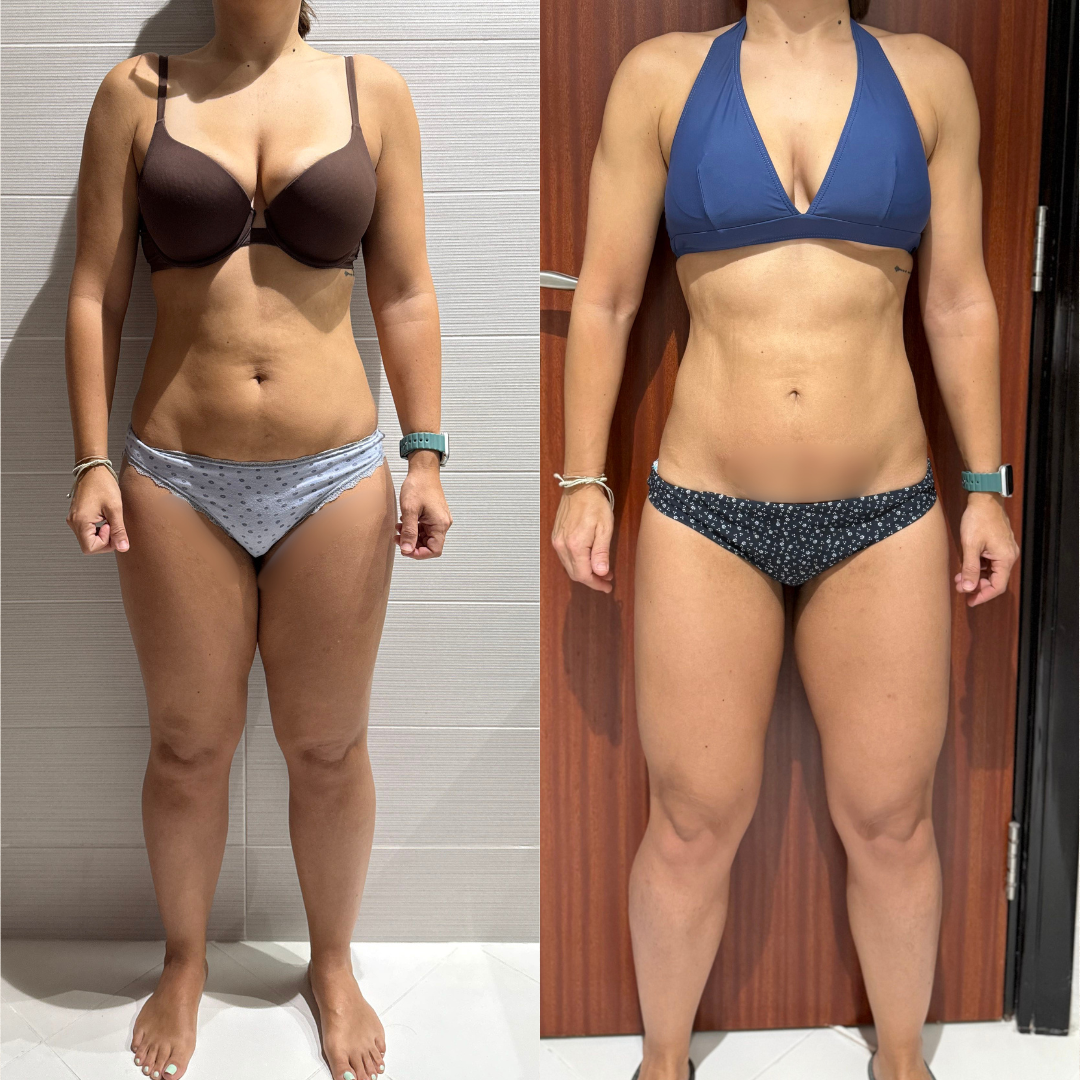Structure transformation