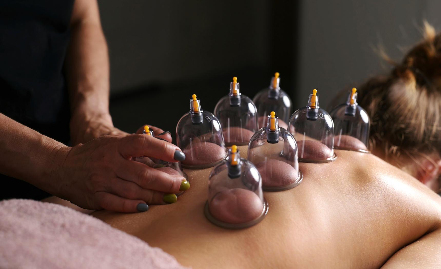 Medi-cupping vacuum suction therapy for muscle hydration and detox at Bodywork Innovations Redding CA