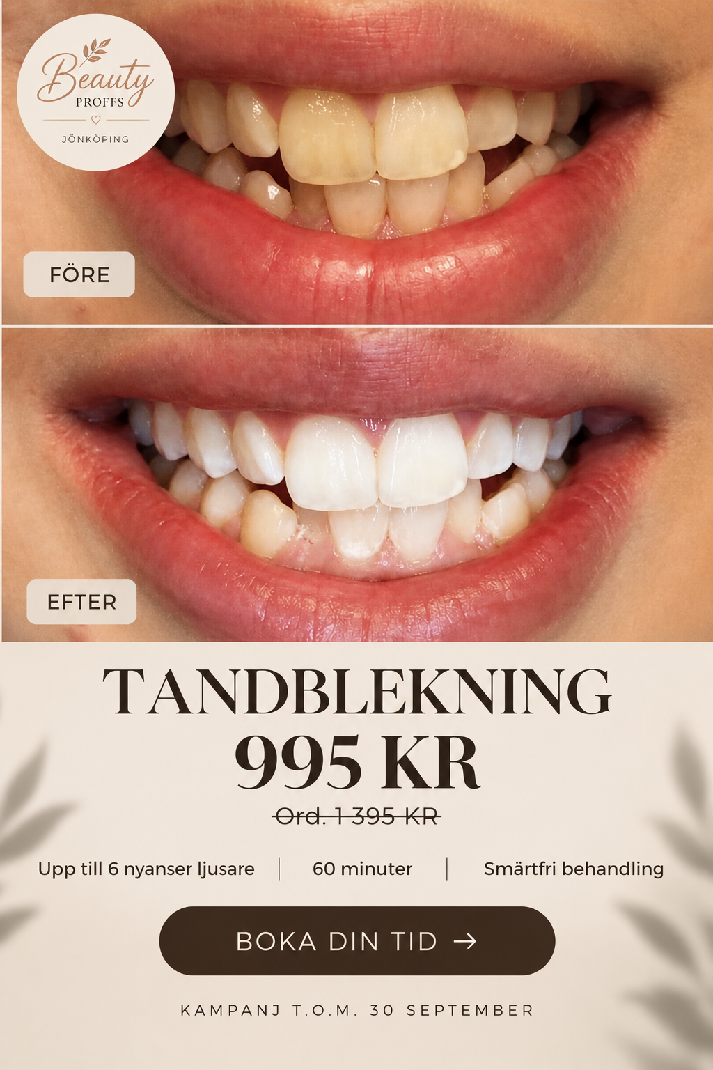 Vita tänder efter tandblekning hos Beauty Proffs