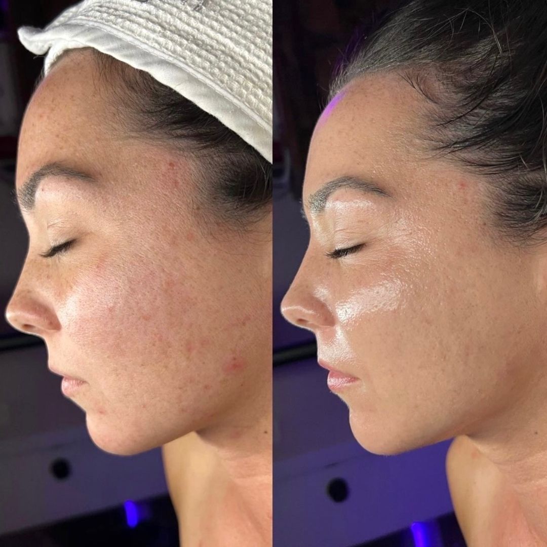 Antes y después del tratamiento