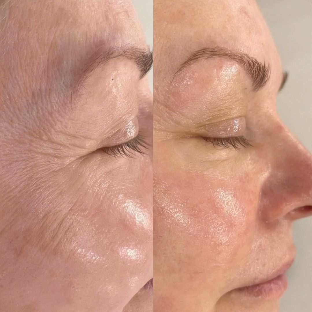 Antes y después del tratamiento