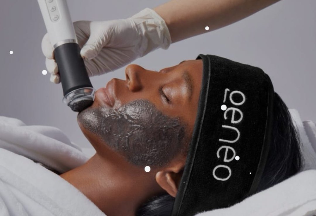 Resultado real: antes y después