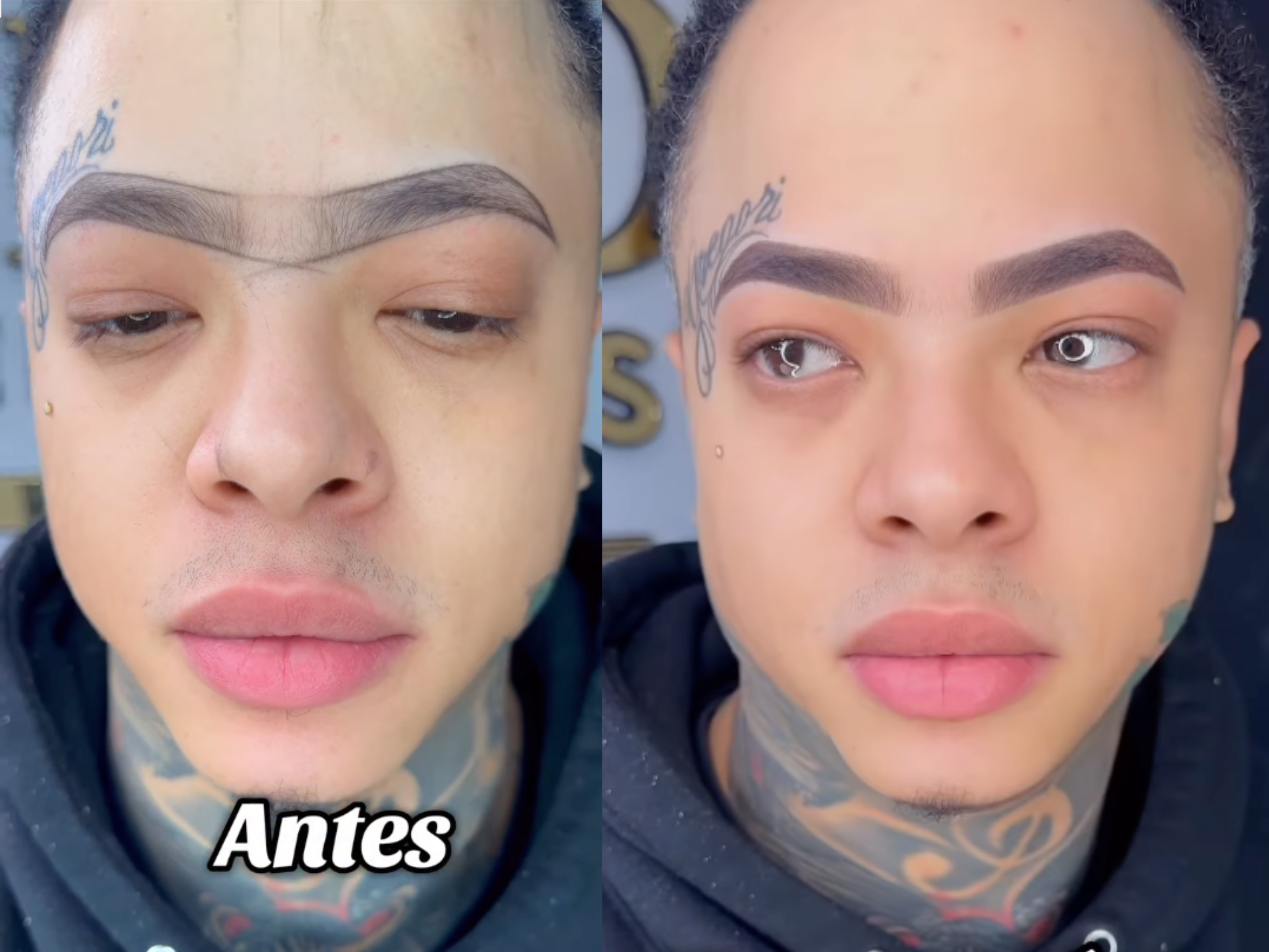 Antes y Después 7