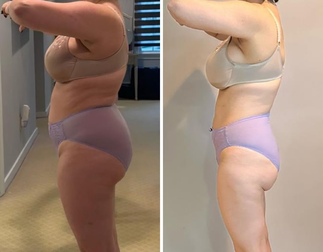 Samantha's before and after transformation