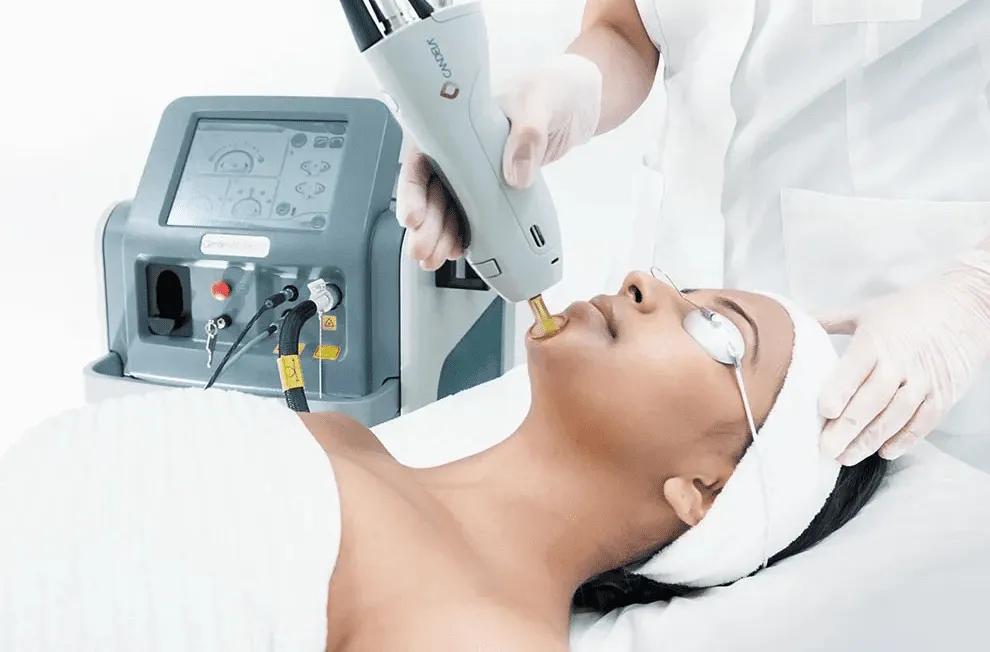GentleMax Pro laser hair removal