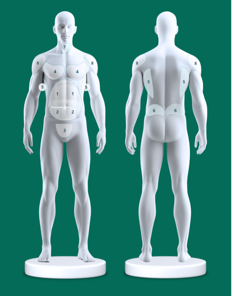 Front and vback view of male torso showing Vaser liposuction treatment areas for men