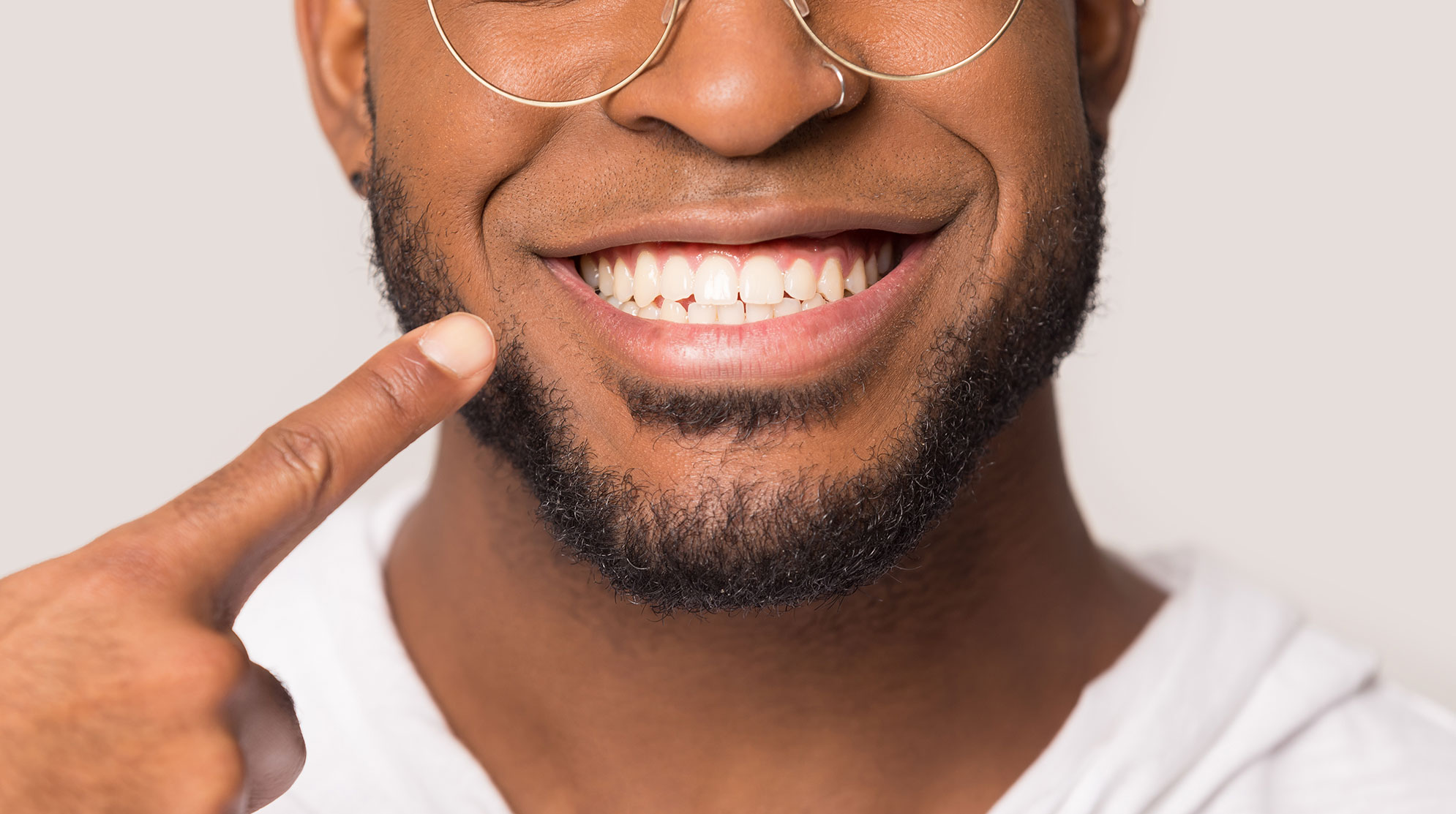 Patient that got teeth whitening