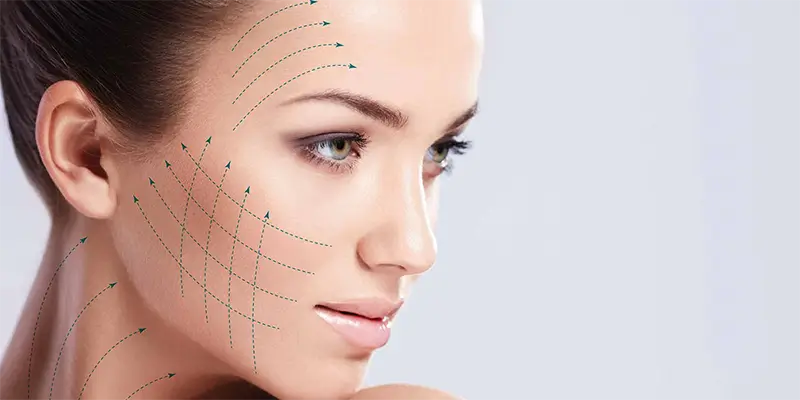 Microneedling treatment