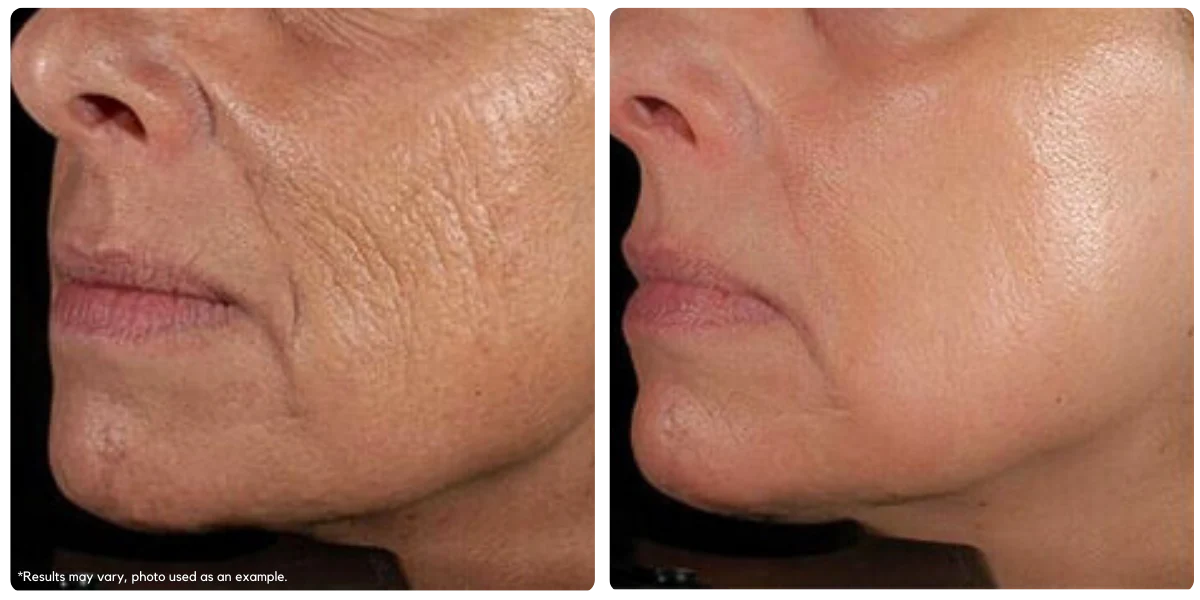 Before and After — Client 2